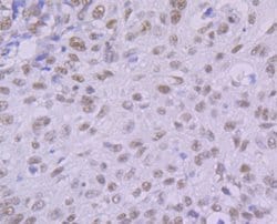 Invitrogen KHSRP Recombinant Rabbit Monoclonal Antibody (JE41-64) 100 &mu;L;