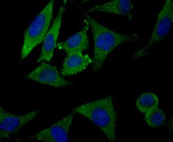 Invitrogen CLASP1 Recombinant Rabbit Monoclonal Antibody (JE43-19) 100
