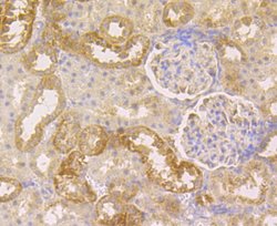 Invitrogen CLASP1 Recombinant Rabbit Monoclonal Antibody (JE43-19) 100