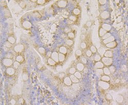 Invitrogen CLASP1 Recombinant Rabbit Monoclonal Antibody (JE43-19) 100
