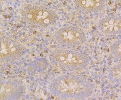 Invitrogen CLASP1 Recombinant Rabbit Monoclonal Antibody (JE43-19) 100