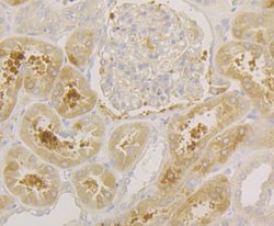 Invitrogen SRP54 Recombinant Rabbit Monoclonal Antibody (JE43-25) 100 &mu;L;