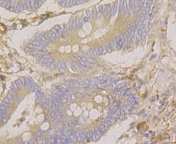 Invitrogen SRP54 Recombinant Rabbit Monoclonal Antibody (JE43-25) 100 &mu;L;