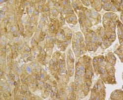 Invitrogen Kininogen 1 Recombinant Rabbit Monoclonal Antibody (JE43-72)