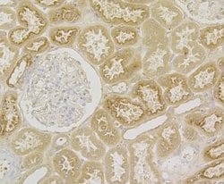Invitrogen Kininogen 1 Recombinant Rabbit Monoclonal Antibody (JE43-72)