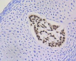 Invitrogen Brachyury Recombinant Rabbit Monoclonal Antibody (JE44-11) 100