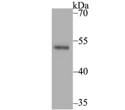 Invitrogen Brachyury Recombinant Rabbit Monoclonal Antibody (JE44-11) 100