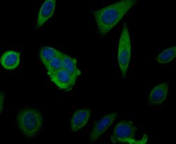 Invitrogen MARK3 Recombinant Rabbit Monoclonal Antibody (JE44-84) 100 &mu;L;
