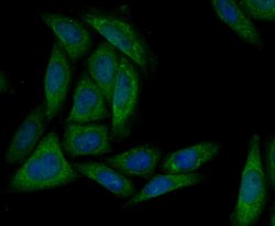 Invitrogen MARK3 Recombinant Rabbit Monoclonal Antibody (JE44-84) 100 &mu;L;
