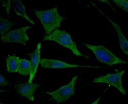 Invitrogen MARK3 Recombinant Rabbit Monoclonal Antibody (JE44-84) 100 &mu;L;