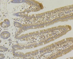 Invitrogen MARK3 Recombinant Rabbit Monoclonal Antibody (JE44-84) 100 &mu;L;