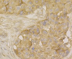 Invitrogen MARK3 Recombinant Rabbit Monoclonal Antibody (JE44-84) 100 &mu;L;
