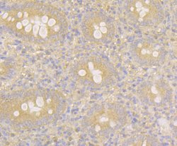 Invitrogen MARK3 Recombinant Rabbit Monoclonal Antibody (JE44-84) 100 &mu;L;