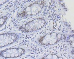 Invitrogen RNF40 Recombinant Rabbit Monoclonal Antibody (JE46-30) 100 &mu;L;