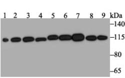 Invitrogen RNF40 Recombinant Rabbit Monoclonal Antibody (JE46-30) 100 &mu;L;