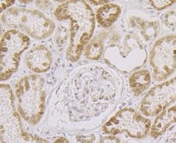 Invitrogen SRSF3 Recombinant Rabbit Monoclonal Antibody (JE46-44) 100 &mu;L;