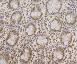 Invitrogen SRSF3 Recombinant Rabbit Monoclonal Antibody (JE46-44) 100 &mu;L;