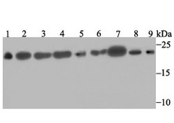 Invitrogen SRSF3 Recombinant Rabbit Monoclonal Antibody (JE46-44) 100 &mu;L;
