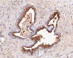 Invitrogen NDUFAF1 Recombinant Rabbit Monoclonal Antibody (JE47-18) 100