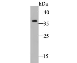 Invitrogen NDUFAF1 Recombinant Rabbit Monoclonal Antibody (JE47-18) 100