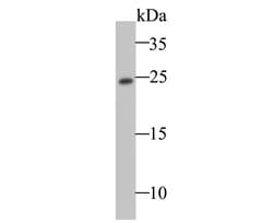 Invitrogen TC10 Recombinant Rabbit Monoclonal Antibody (JE47-25) 100 &mu;L;
