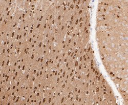 Invitrogen TPPP Recombinant Rabbit Monoclonal Antibody (JE47-35) 100 &mu;L;