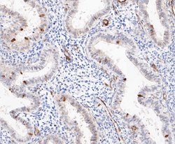 Invitrogen TPPP Recombinant Rabbit Monoclonal Antibody (JE47-35) 100 &mu;L;