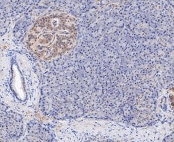 Invitrogen TPPP Recombinant Rabbit Monoclonal Antibody (JE47-35) 100 &mu;L;
