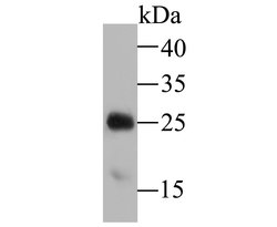 Invitrogen TPPP Recombinant Rabbit Monoclonal Antibody (JE47-35) 100 &mu;L;