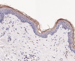 Invitrogen GSTK1 Recombinant Rabbit Monoclonal Antibody (JE47-38) 100 &mu;L;