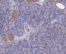 Invitrogen GSTK1 Recombinant Rabbit Monoclonal Antibody (JE47-38) 100 &mu;L;