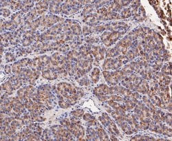 Invitrogen GSTK1 Recombinant Rabbit Monoclonal Antibody (JE47-38) 100 &mu;L;