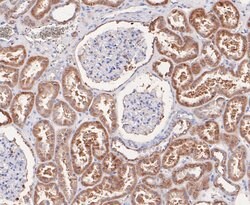 Invitrogen GSTK1 Recombinant Rabbit Monoclonal Antibody (JE47-38) 100 &mu;L;