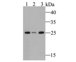 Invitrogen GSTK1 Recombinant Rabbit Monoclonal Antibody (JE47-38) 100 &mu;L;