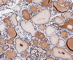 Invitrogen GTPBP4 Recombinant Rabbit Monoclonal Antibody (JE47-47) 100