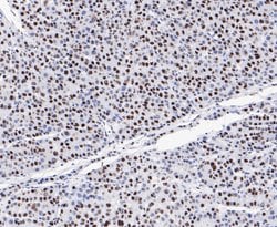 Invitrogen GTPBP4 Recombinant Rabbit Monoclonal Antibody (JE47-47) 100