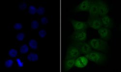 Invitrogen COPS3 Recombinant Rabbit Monoclonal Antibody (JE47-48) 100 &mu;L;
