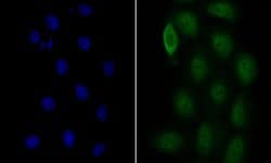 Invitrogen COPS3 Recombinant Rabbit Monoclonal Antibody (JE47-48) 100 &mu;L;