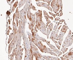 Invitrogen COPS3 Recombinant Rabbit Monoclonal Antibody (JE47-48) 100 &mu;L;