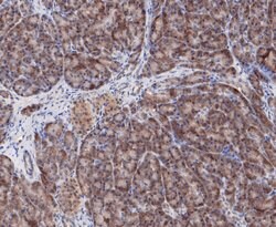 Invitrogen COPS3 Recombinant Rabbit Monoclonal Antibody (JE47-48) 100 &mu;L;