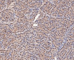 Invitrogen COPS3 Recombinant Rabbit Monoclonal Antibody (JE47-48) 100 &mu;L;
