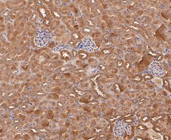 Invitrogen Calpain S1 Recombinant Rabbit Monoclonal Antibody (JE47-72) 100 &mu;L | Buy Online | Invitrogen&trade; | Fisher Scientific