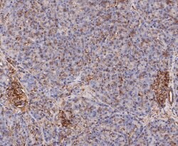 Invitrogen Calpain S1 Recombinant Rabbit Monoclonal Antibody (JE47-72) 100 &mu;L | Buy Online | Invitrogen&trade; | Fisher Scientific