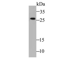 Invitrogen Calpain S1 Recombinant Rabbit Monoclonal Antibody (JE47-72) 100 &mu;L | Buy Online | Invitrogen&trade; | Fisher Scientific