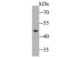 Invitrogen ACADM Recombinant Rabbit Monoclonal Antibody (JE48-09) 100 &mu;L | Buy Online | Invitrogen&trade; | Fisher Scientific