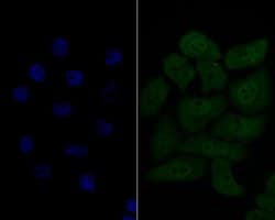 Invitrogen HSF2 Recombinant Rabbit Monoclonal Antibody (JE48-40) 100 &mu;L;