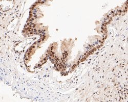 Invitrogen HSF2 Recombinant Rabbit Monoclonal Antibody (JE48-40) 100 &mu;L;