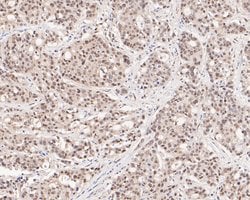 Invitrogen HSF2 Recombinant Rabbit Monoclonal Antibody (JE48-40) 100 &mu;L;
