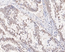 Invitrogen HSF2 Recombinant Rabbit Monoclonal Antibody (JE48-40) 100 &mu;L;