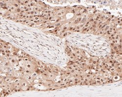 Invitrogen HSF2 Recombinant Rabbit Monoclonal Antibody (JE48-40) 100 &mu;L;